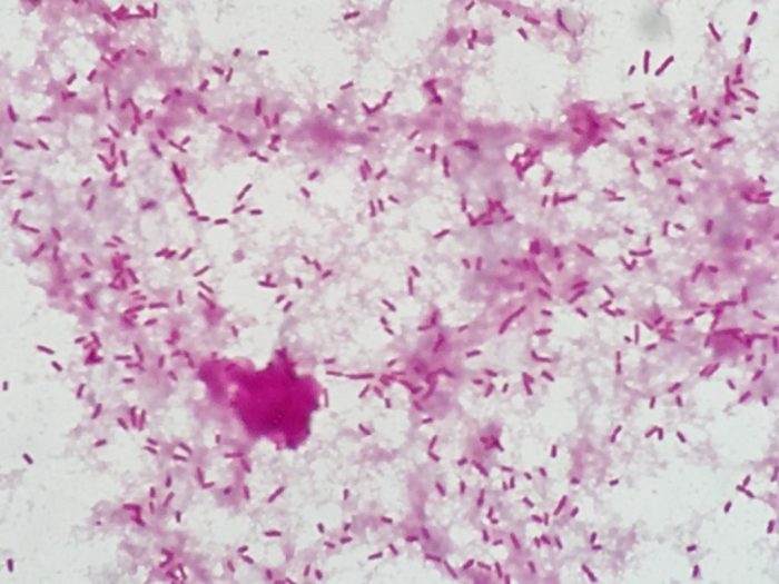 Serratia marcescens gram stain 1000x