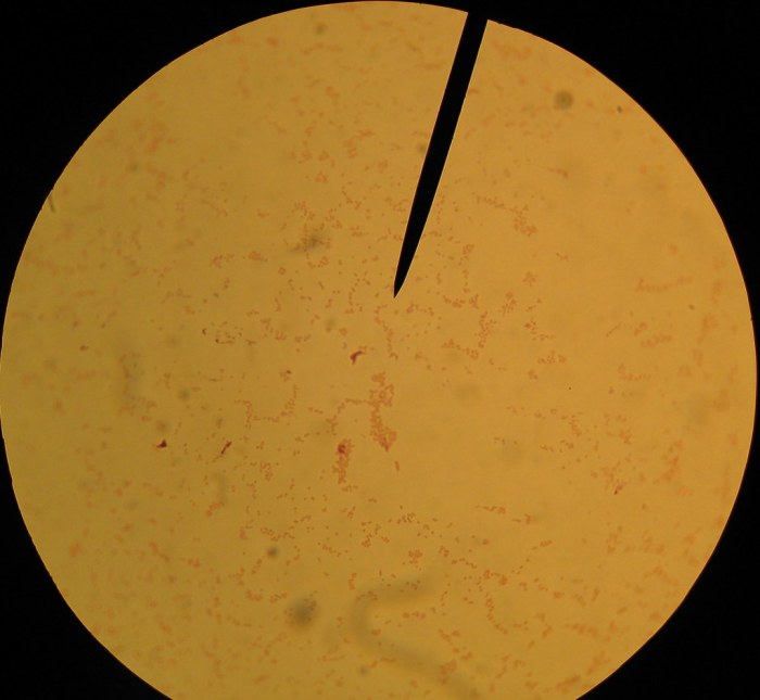 Bacteroides fragilis gram bacteria 1000x negative magnified stain phil publicdomainfiles subsp cdc gut photomicrograph depicted numbers which newly discovered magnification