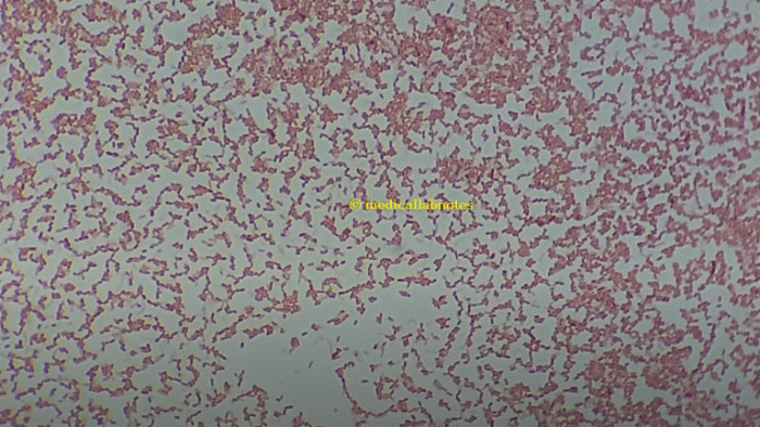 Serratia marcescens bacteria species