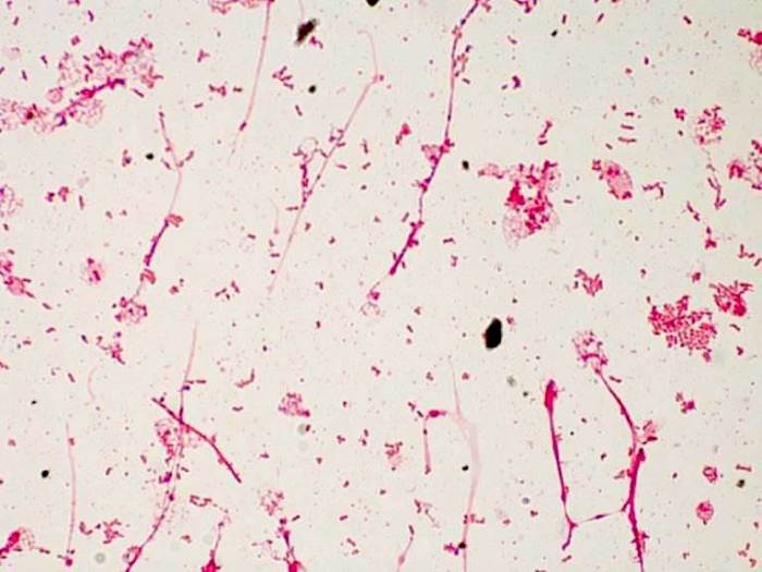 Serratia marcescens gram stain 1000x